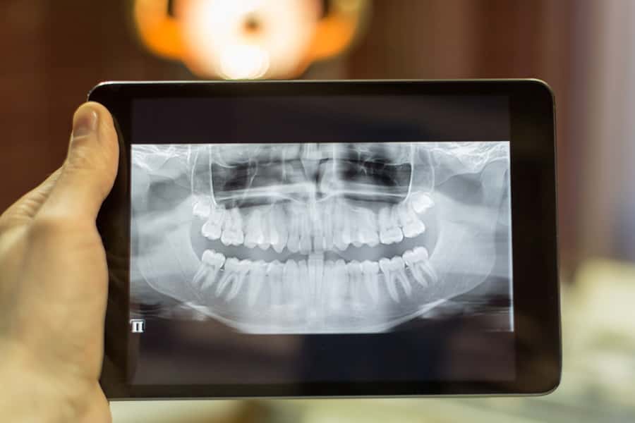Digital Radiography in Lombard, IL